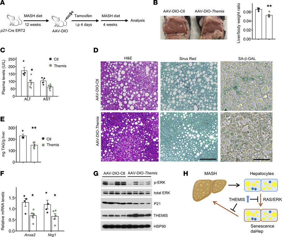 Hepatocyte senescence promotes MASH progression.
(A) Study design of uti...