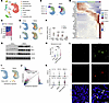 Single-nucleus RNA-seq analysis of healthy and diet-induced MASH livers.
