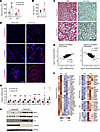 Themis deficiency accelerates diet-induced MASH progression.