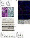 Hepatocyte-specific Themis overexpression attenuates hepatocyte senescence