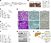 Hepatocyte senescence promotes MASH progression.