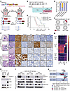 EED inactivation at tumor initiation prevents emergence of SCLC histology i