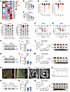 Validation of CC molecular subtypes through experimental assays.