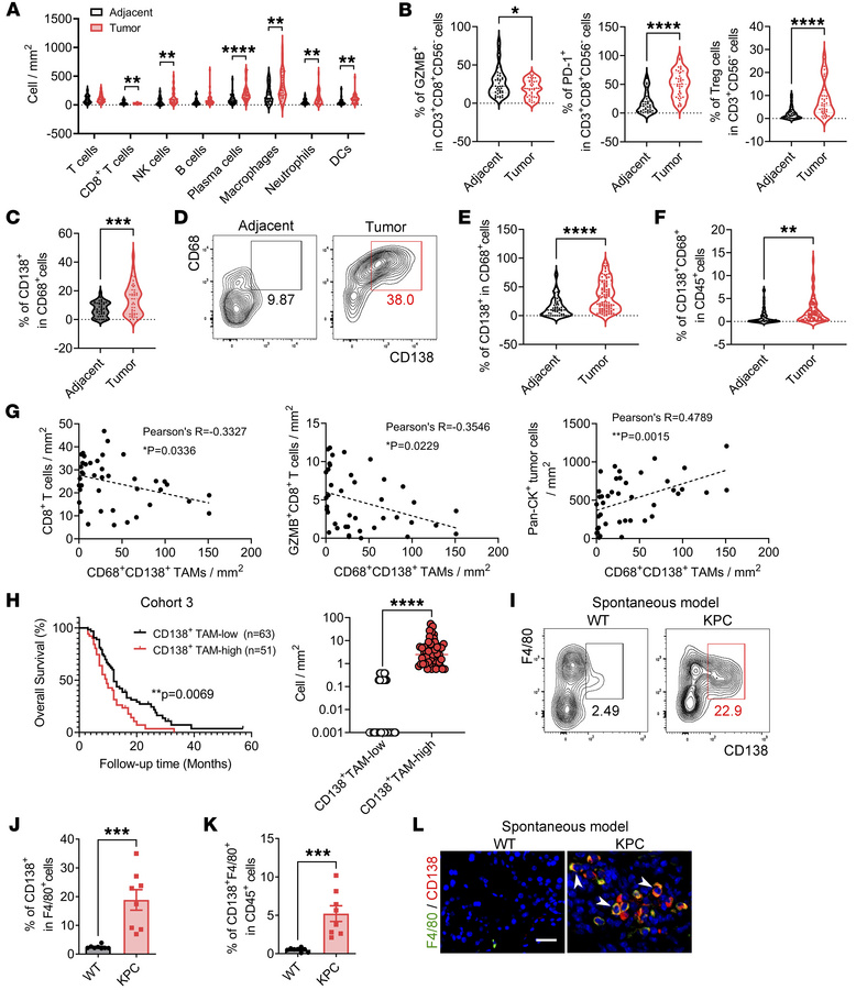 A CD138+ TAM subpopulation is identified and associated with immune evas...