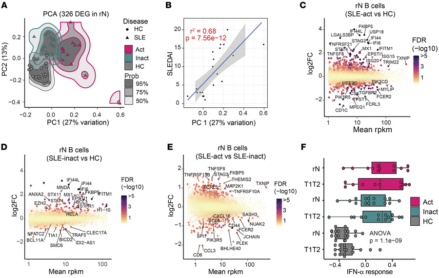The distinct transcriptomes of active and inactive SLE B cells.
(A) PCA ...