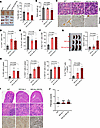 Aged MplW514L mice progressed to myelofibrosis.