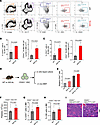 MplW514L mutation drove the expansion of CD201+ HSCs to initiate MPN.
