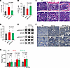 Fedratinib alleviated MPN features in MplW514L mice but failed to eliminate