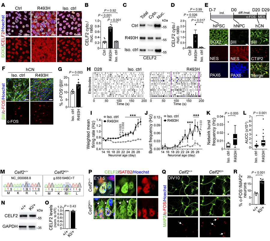 The p.Arg493His variant causes CELF2 mislocalization and neuronal hypera...