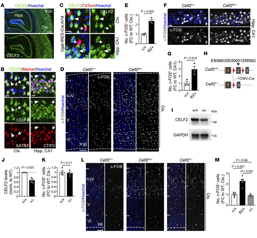 CELF2 mislocalization, not LoF, causes neuronal hyperactivity in mice.
(...