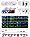 CELF2 missense variants causing CELF2 mislocalization are associated with e