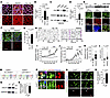 The p.Arg493His variant causes CELF2 mislocalization and neuronal hyperacti