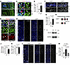 CELF2 mislocalization, not LoF, causes neuronal hyperactivity in mice.