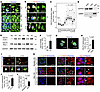 CELF2 shows dynamic subcellular localization in response to neuronal activi