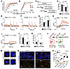 Neuronal hyperactivity caused by CELF2 mislocalization elevates seizure sus