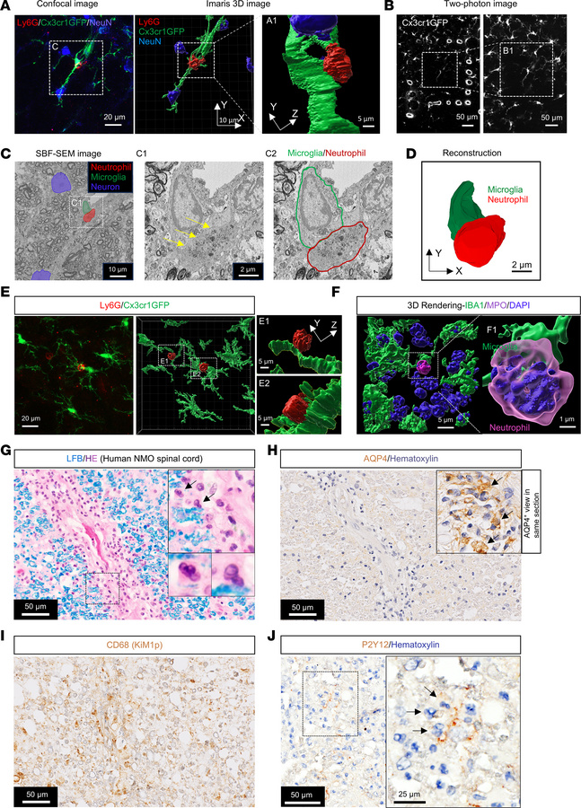 Neutrophil-microglial contacts in lumbar parenchyma, AQP4-IgG infusion d...