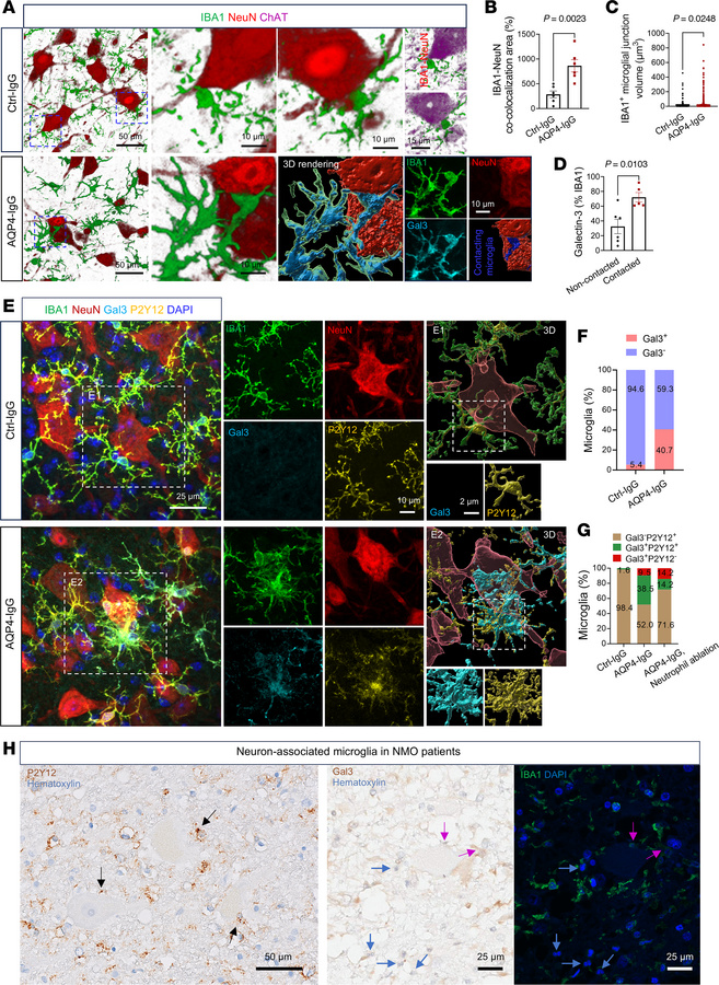 Disease-associated microglia interact with motor neurons in an NMO mouse...