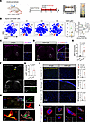 Neutrophils infiltrating and extruding extracellular traps (NETosis) in NMO