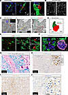 Neutrophil-microglial contacts in lumbar parenchyma, AQP4-IgG infusion day