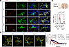 C5ar1 deficiency abrogates downstream microglial activation response to AQP
