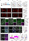 C5ar1 deficiency ameliorates neuronal dysfunction and lipid droplet accumul