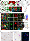 Disease-associated microglia interact with motor neurons in an NMO mouse mo