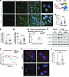 SLC15A3 colocalizes with mTOR in 6MP-resistant lymphoma.