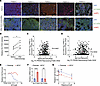 Targeting nucleotide biosynthesis upregulates SLC15A3 in lymphoma patients’
