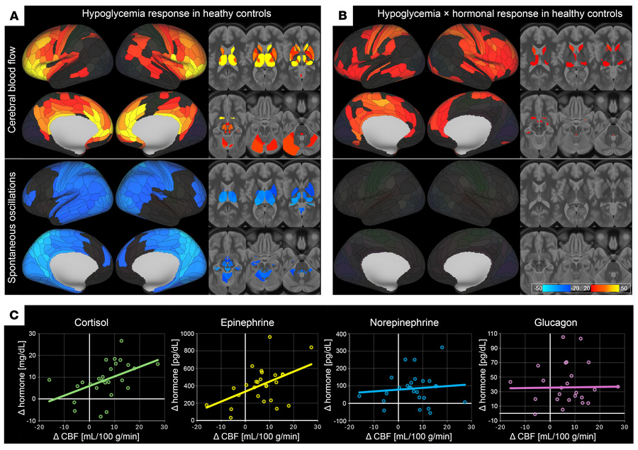 Cerebral hemodynamic response to HG in HCs.
(A) HG > EU contrast for ...