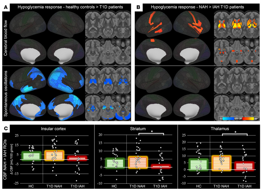 Group contrasts for cerebral hemodynamic response to HG.
(A) HCs versus ...