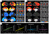 Cerebral hemodynamic response to HG in HCs.