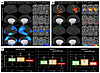 Group contrasts for cerebral hemodynamic response to HG.