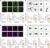 Morphology of Iba1+ and GFAP+ cells is modulated by ASC following CHI.