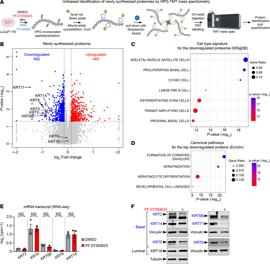 Loss of basal cell identity upon inhibition of the eIF4E cap-binding dom...