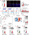 Deubiquitinases OTUD3 and BAP1 prevent AR degradation upon eIF4E cap-bindin
