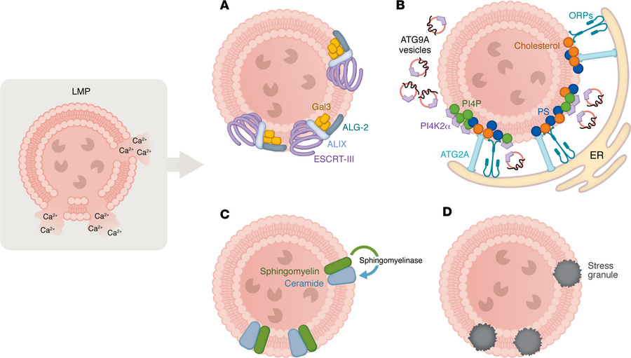 Mechanisms of lysosomal membrane repair.
(A) The ESCRT machinery, recrui...