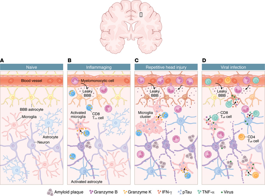 External factors that reshape CNS immunity and influence neurodegenerati...