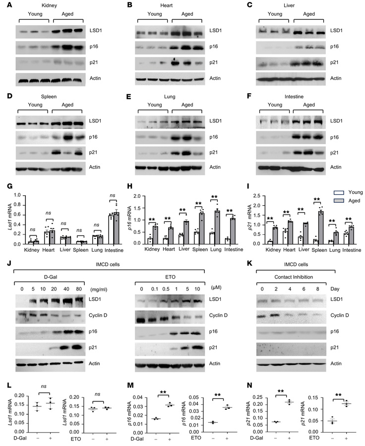 The expression of LSD1 is increased in aged organs and senescent cells.
...