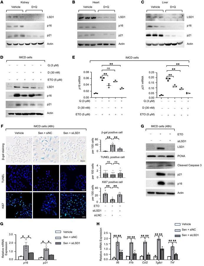 Targeting LSD1 decreases cellular senescence and elimination of senescen...