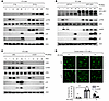Increased LSD1 is involved in DNA damage–mediated senescence and DNA damage