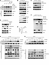 LSD1 demethylates ATM at K3016, and LSD1 mediated demethylation of ATM inhi