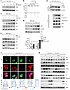 LSD1 is subjected to autophagosome-lysosome degradation during cellular sen