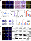 TGF-β controls LPC proliferation.