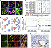 TGF-β, HGF, and EGF signaling are predominant in proliferating LPCs.