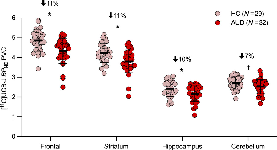 Synaptic density levels by diagnostic group.
PVC BPND values were lower ...