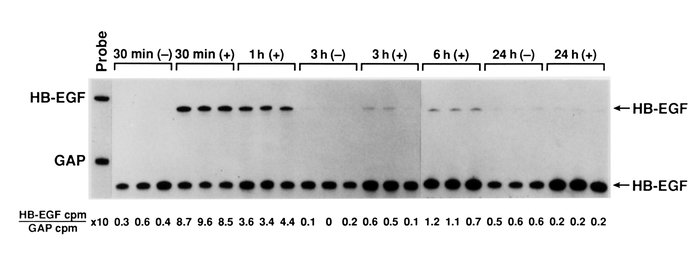 RNase protection assay analysis of mRNA for HB-EGF and GAPDH in glomerul...
