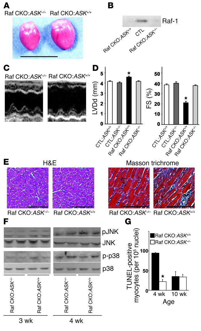 Prevention of cardiac dysfunction in Raf-1/ASK1 double-knockout mice. (A...