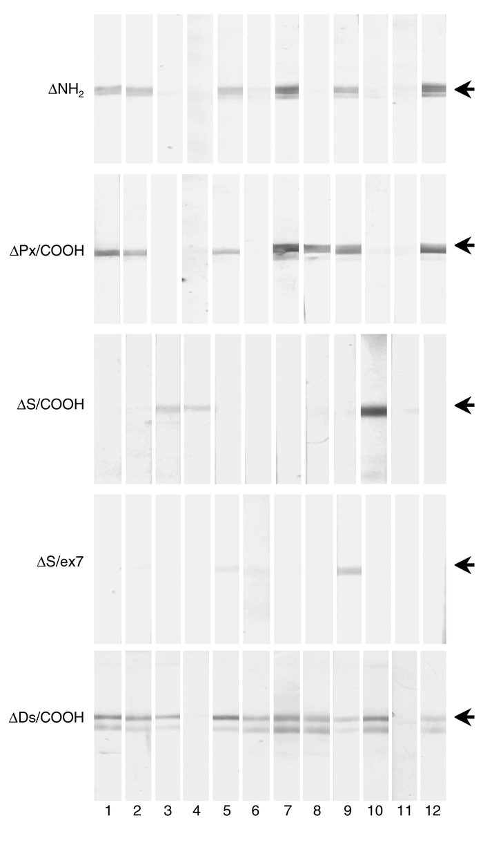 Immunoblotting for lichen sclerosus sera by use of a series of recombina...