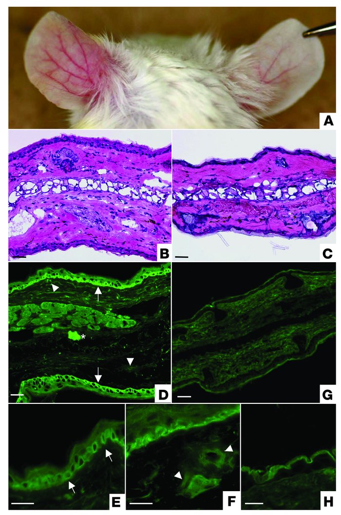 Passive-transfer study using affinity-purified lichen sclerosus IgG in n...