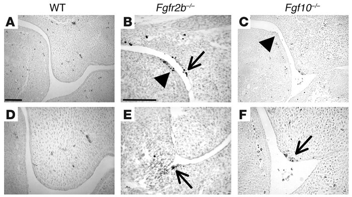 Detection of TUNEL-positive cells in the posterior oral cavity of WT, Fg...